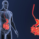 Illustration for article titled Find A Quick Way To non ulcer dyspepsiaem/em